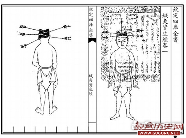 古人控制人口的方法:堕胎、避孕与绝育